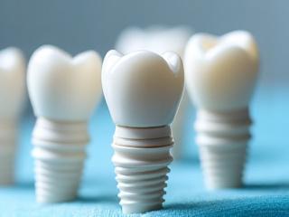 Implanty ceramiczne stomatologiczne