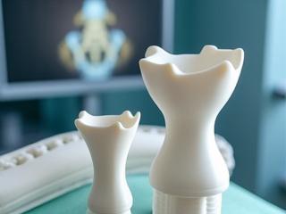 Rekonstrukcja kostna implanty ceramiczne